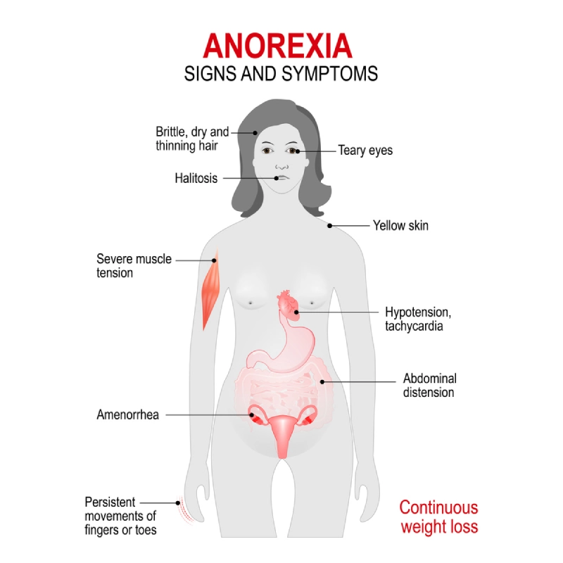 anorexia signs and symptoms