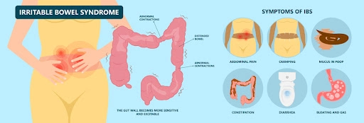 Irritable bowel Syndrome